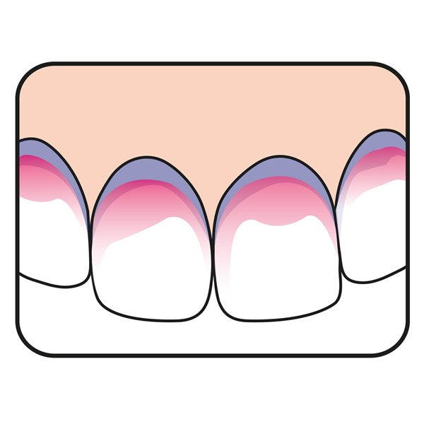 Pastillas detectores de placa TePe PlaqSearch ™ higiene dental