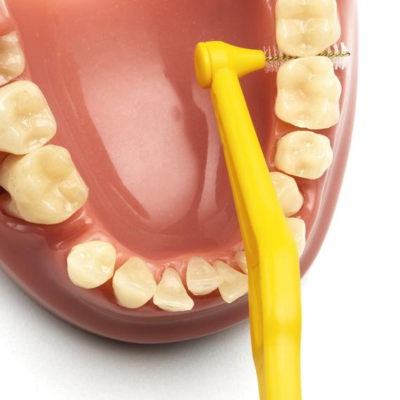 cepillo interdental intraproximal tepe higiene dental, gengivitis y mal aliento