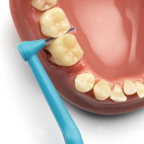 cepillo interdental intraproximal tepe higiene dental, gengivitis y mal aliento