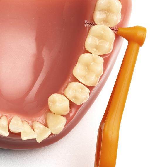 cepillo interdental intraproximal tepe higiene dental, gengivitis y mal aliento