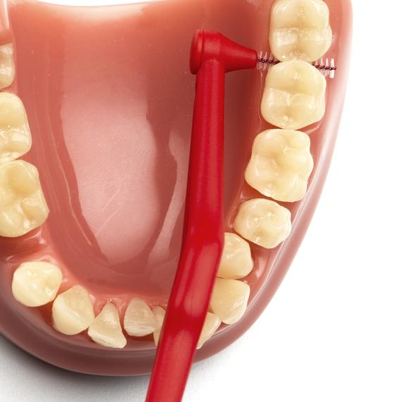 cepillo interdental intraproximal tepe higiene dental, gengivitis y mal aliento