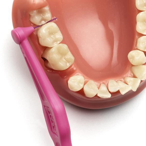 cepillo interdental intraproximal tepe higiene dental, gengivitis y mal aliento
