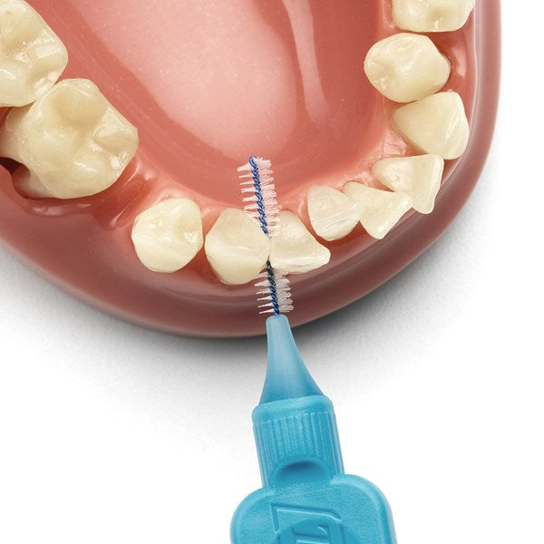 cepillo interdental intraproximal tepe higiene dental, gengivitis y mal aliento