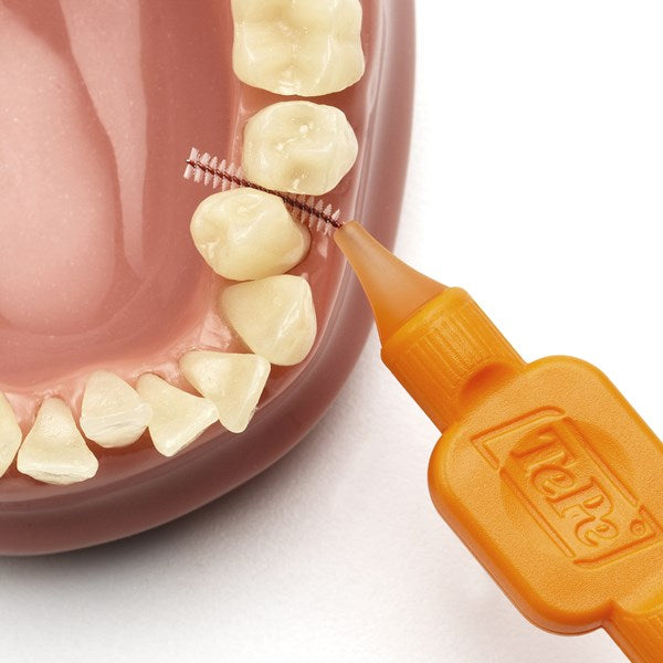 cepillo interdental intraproximal tepe higiene dental, gengivitis y mal aliento