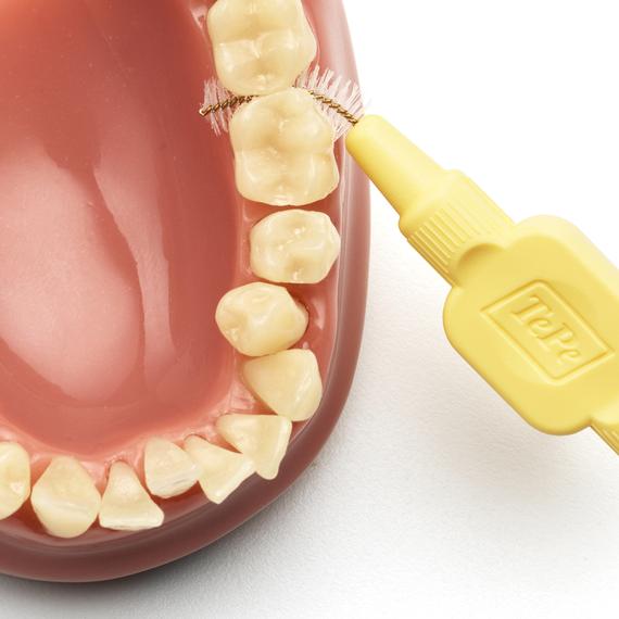 cepillo interdental intraproximal tepe higiene dental, gengivitis y mal aliento