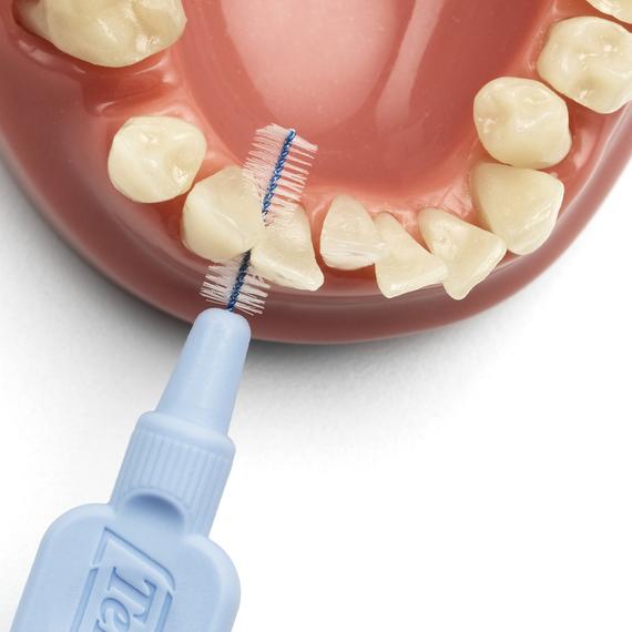 cepillo interdental intraproximal tepe higiene dental, gengivitis y mal aliento