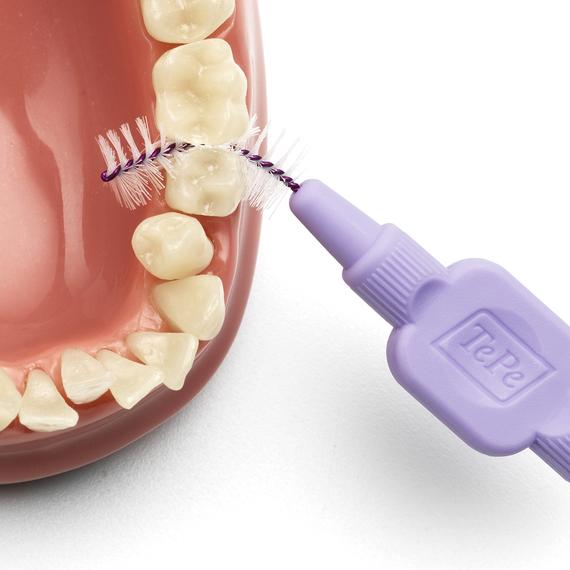 cepillo interdental intraproximal tepe higiene dental, gengivitis y mal aliento