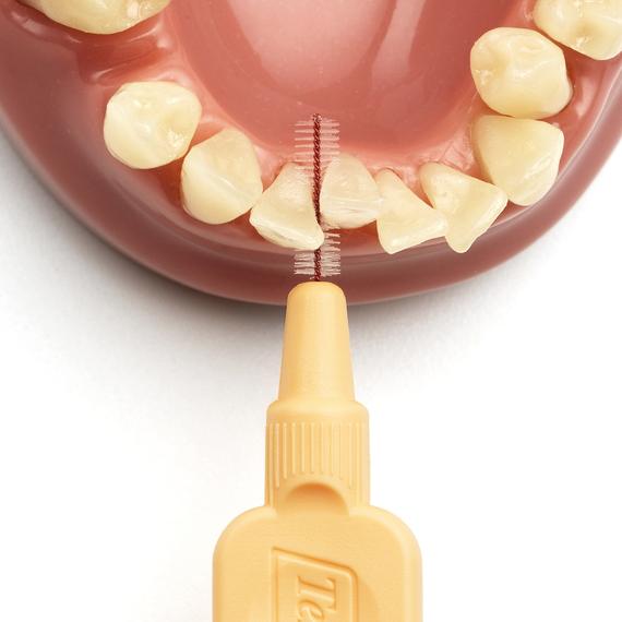 cepillo interdental intraproximal tepe higiene dental, gengivitis y mal aliento