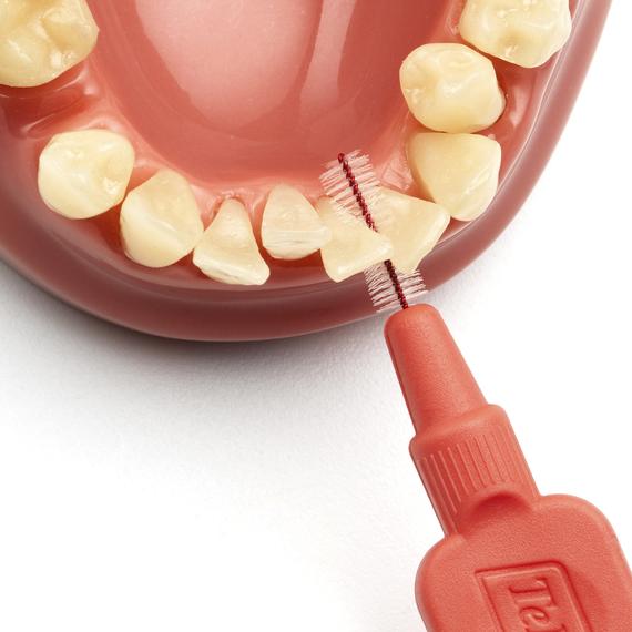 cepillo interdental intraproximal tepe higiene dental, gengivitis y mal aliento