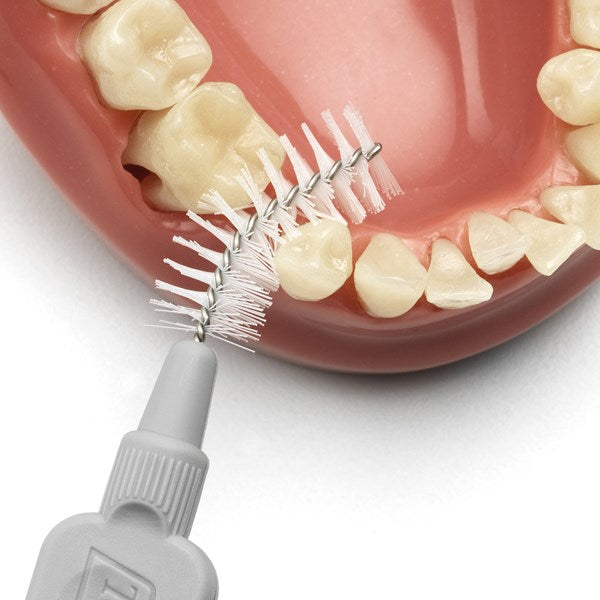 cepillo interdental intraproximal tepe higiene dental, gengivitis y mal aliento
