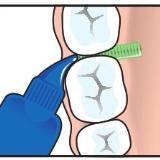 Tepe Gel Gingival interdental encias sanas higiene dental